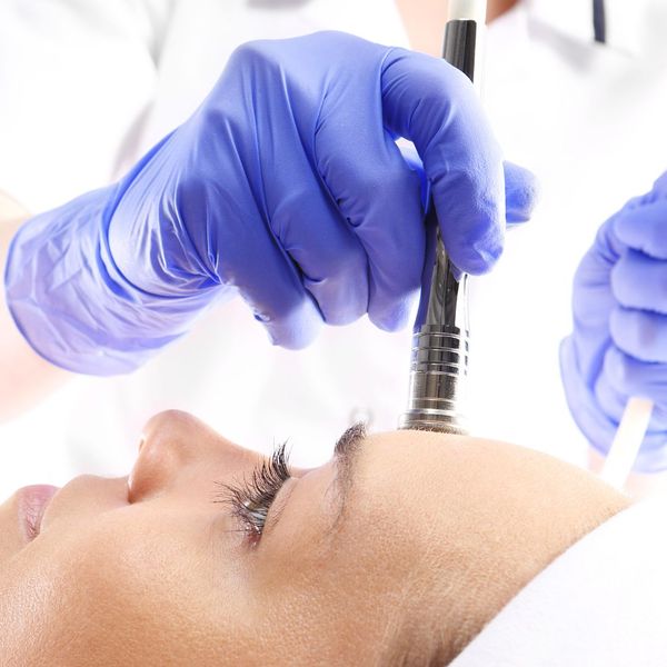 What Does Microdermabrasion Do? ELEVATE Med Spa & Lounge